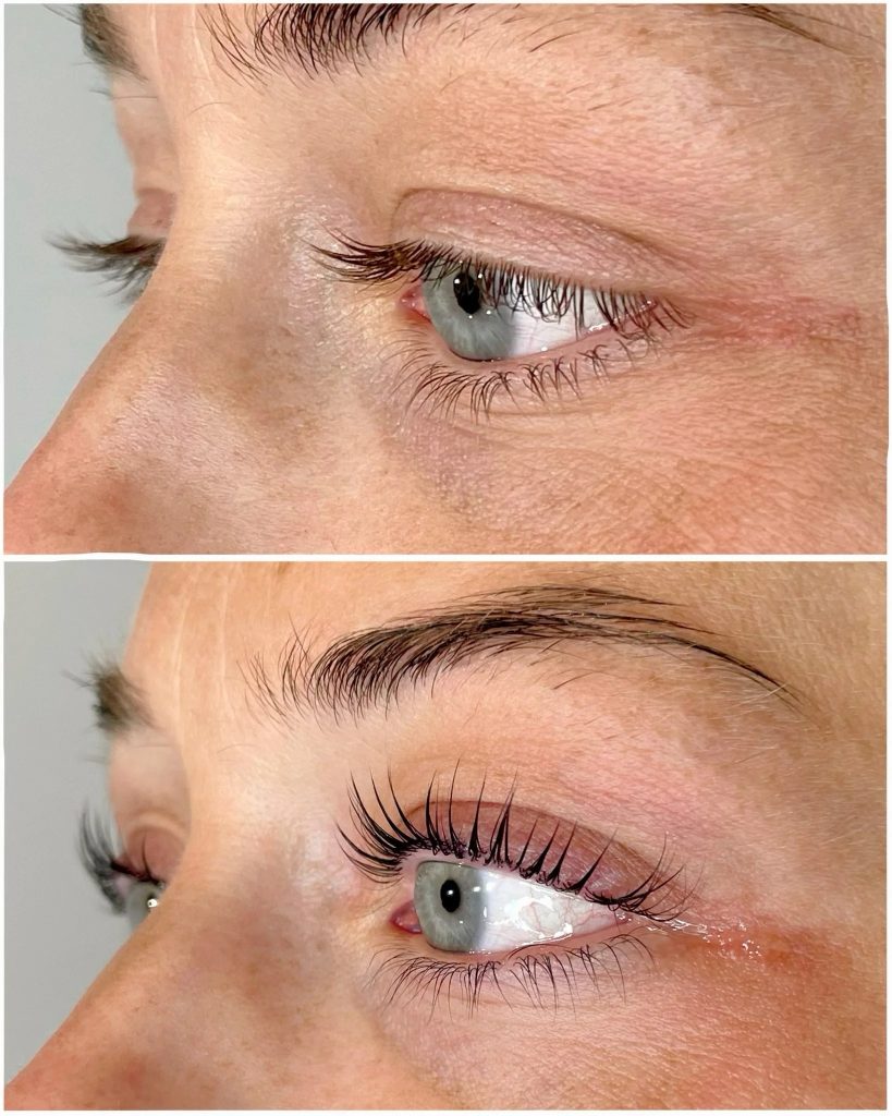 A Friendly Look at a Trusted Skin Clinic Iver Nearby