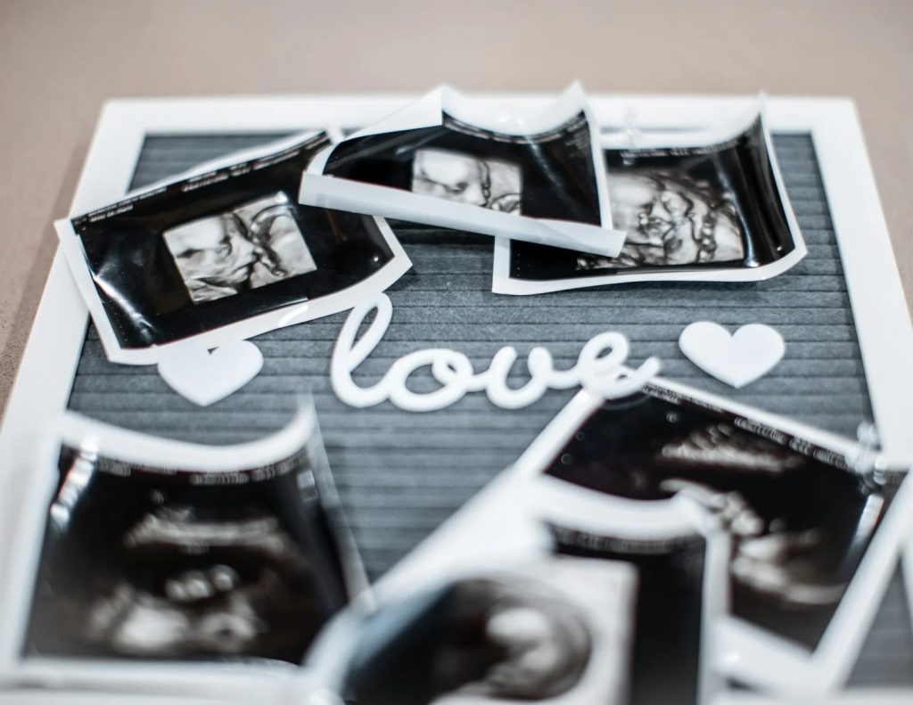 Clear paths to safe imaging: your guide to d ultrasound Perth Clear paths to safe imaging: your guide to d ultrasound Perth