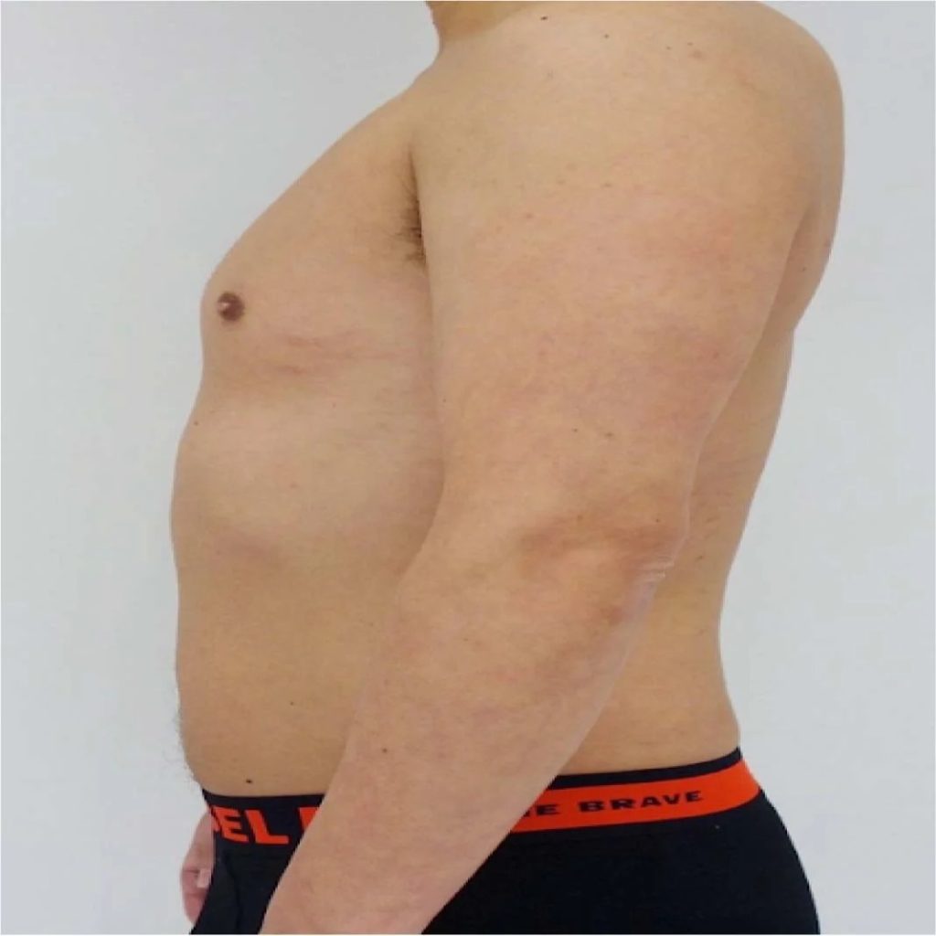 A Smart Guide to Prescription Weight Loss Aids in Malaysia