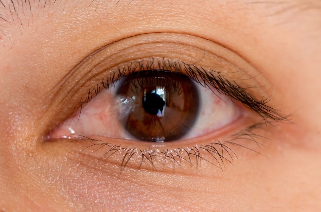 A clear guide to a specific eye surgery topic