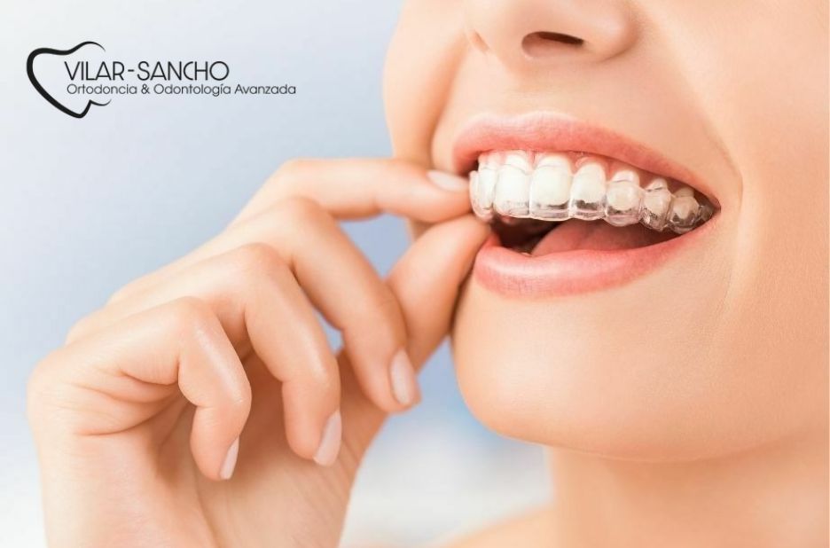 Urgencias dentales en Pozuelo de Alarcón: guía práctica Urgencias dentales en Pozuelo de Alarcón: guía práctica