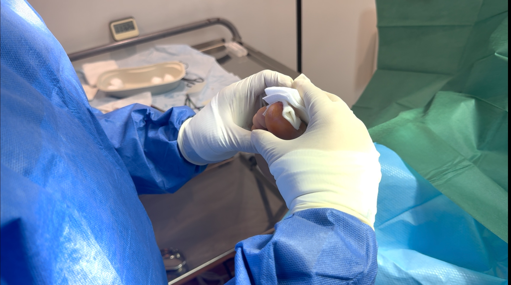 Relief and recovery after nail infection treatment