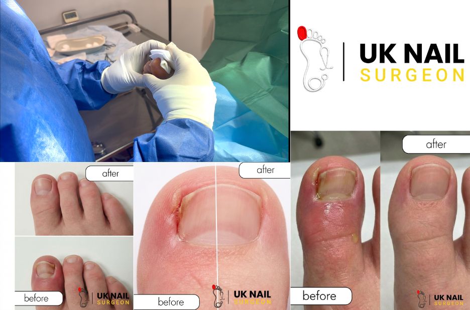 Fast relief for toenail issues nearby Fast relief for toenail issues nearby