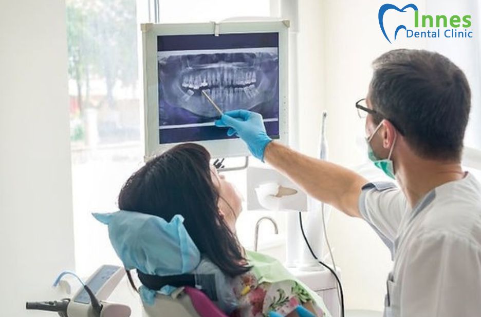 Top Implant Dentist in Orleans: Trusted Care for Your Smile Top Implant Dentist in Orleans: Trusted Care for Your Smile