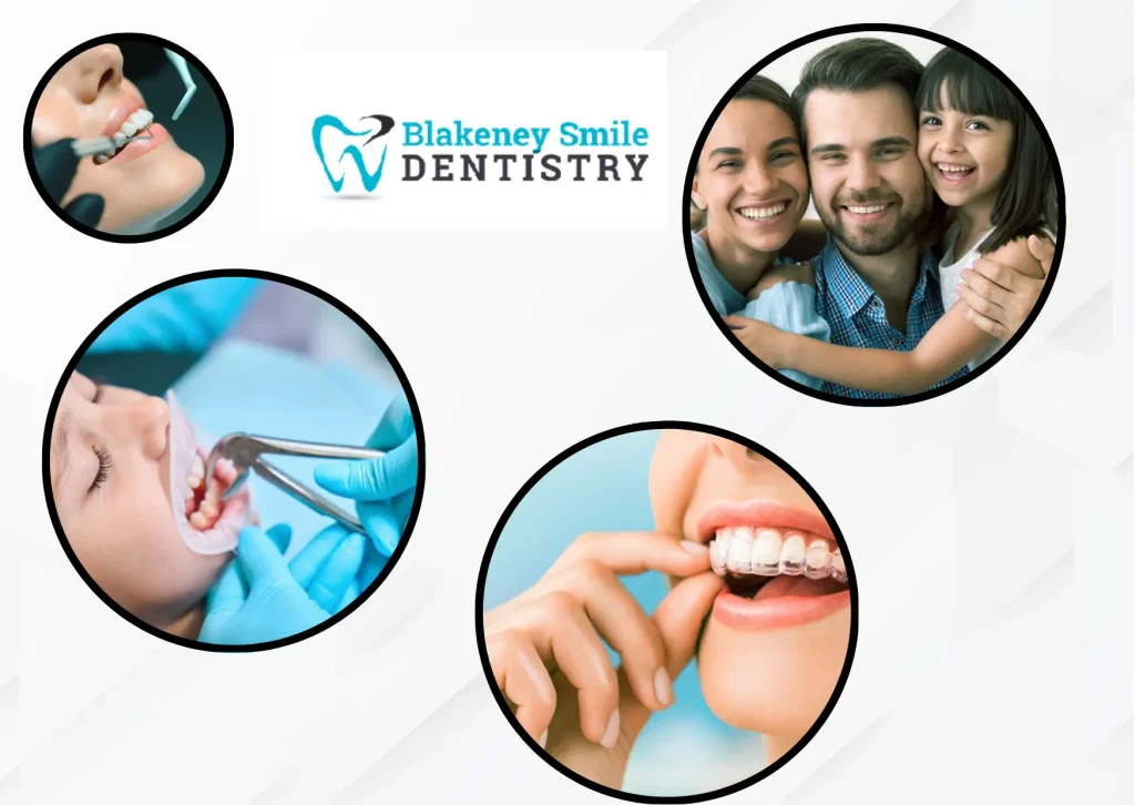 Transform Your Smile with Invisalign in Charlotte NC – Expert Care at Blakeney Smile Dentistry