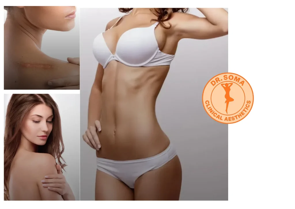 Thread Lift Procedures to Lift and Tighten Sagging Skin for a Youthful Look