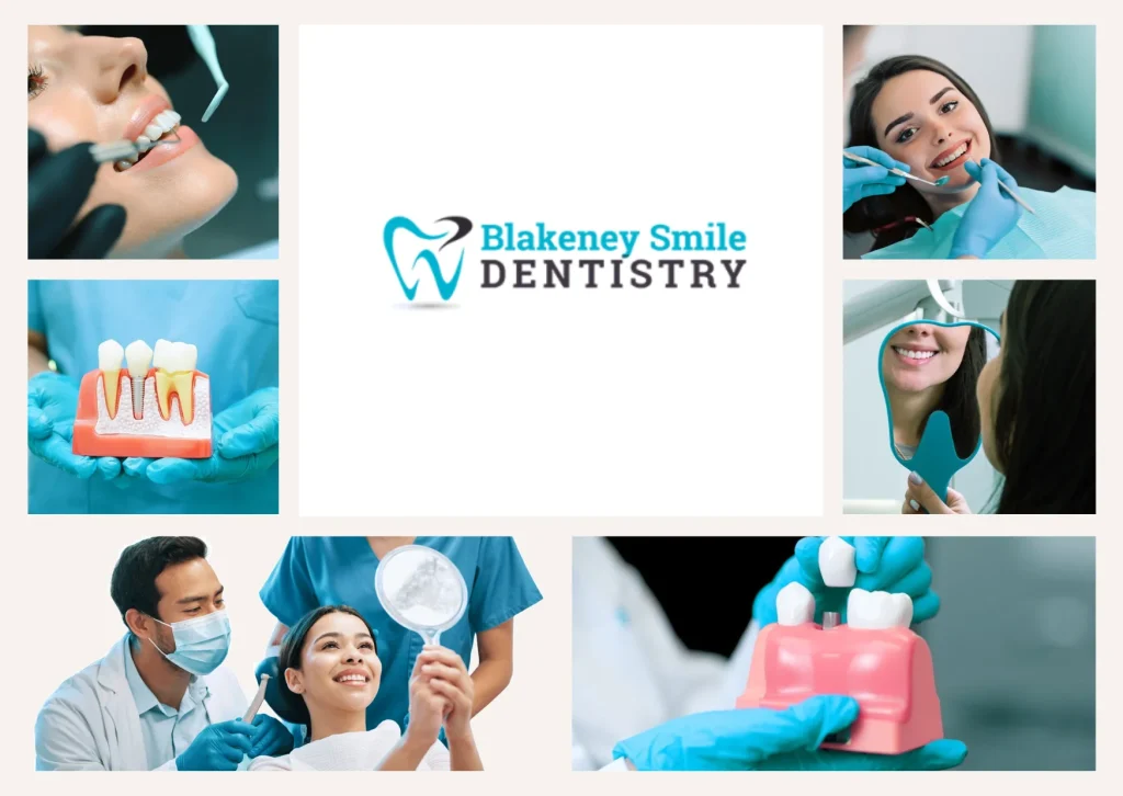 Professional Teeth Whitening Charlotte NC for a Brighter, Confident Smile