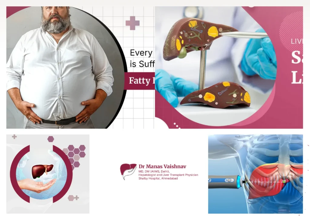 Top Hepatologist in Ahmedabad for Expert Liver and Gastrointestinal Care