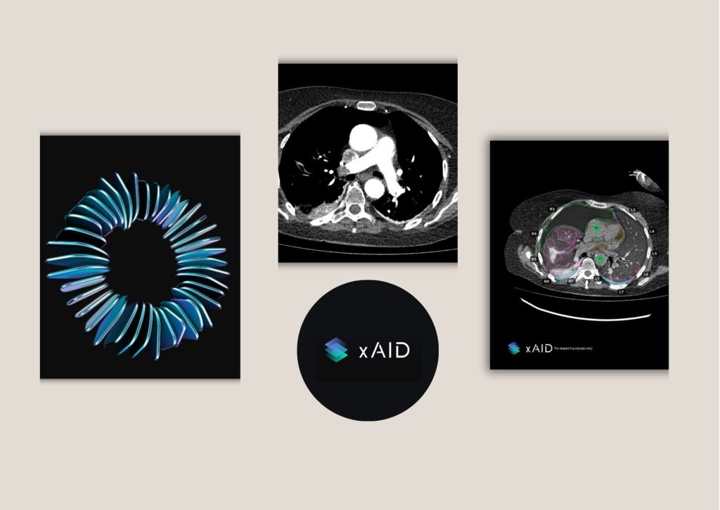 Benefits-First Guide to Smarter Radiology AI Reporting Benefits-First Guide to Smarter Radiology AI Reporting